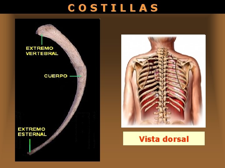 COSTILLAS Vista dorsal 