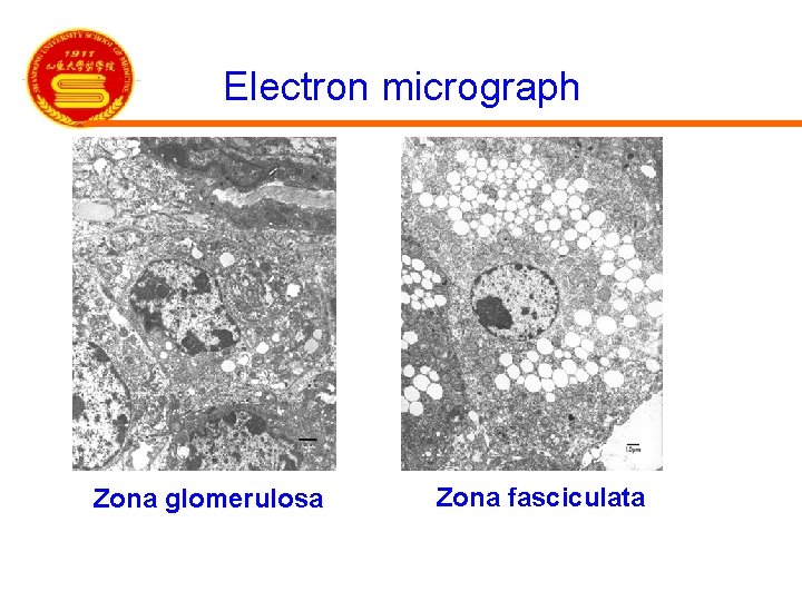 Electron micrograph Zona glomerulosa Zona fasciculata 