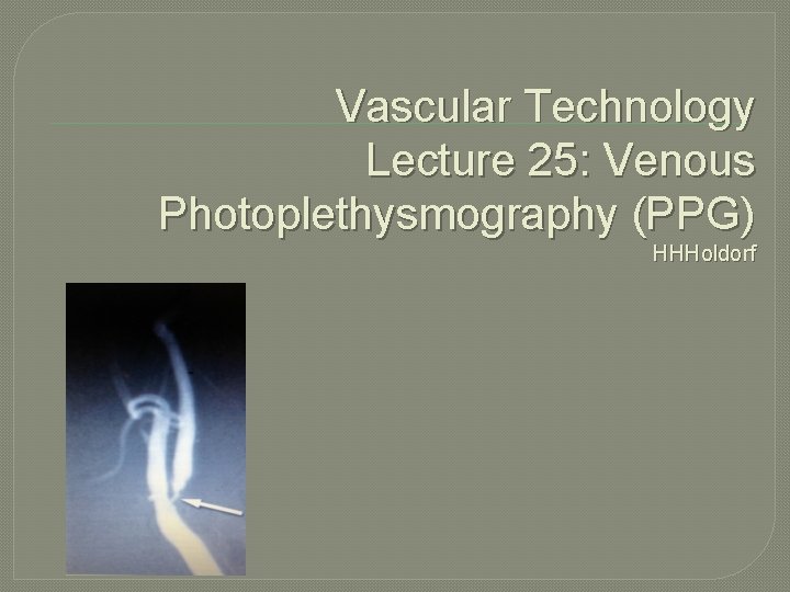 Vascular Technology Lecture 25 Venous Photoplethysmography PPG HHHoldorf