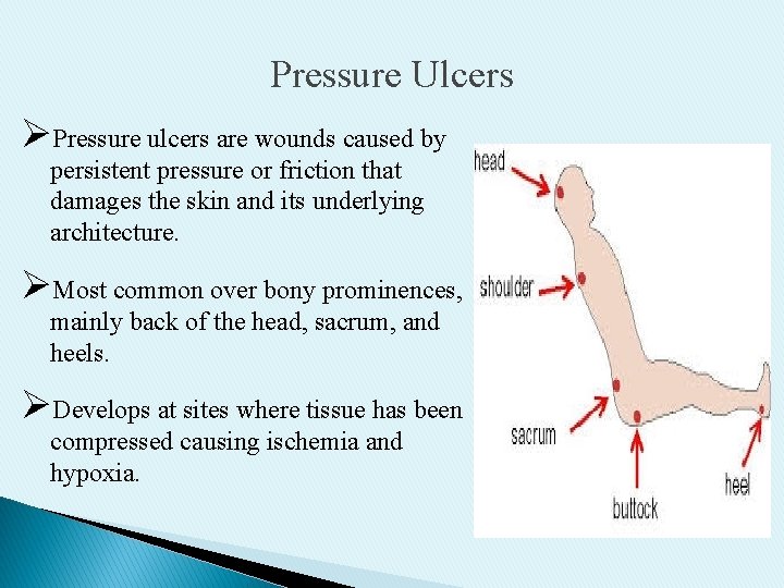Pressure Ulcers ØPressure ulcers are wounds caused by persistent pressure or friction that damages