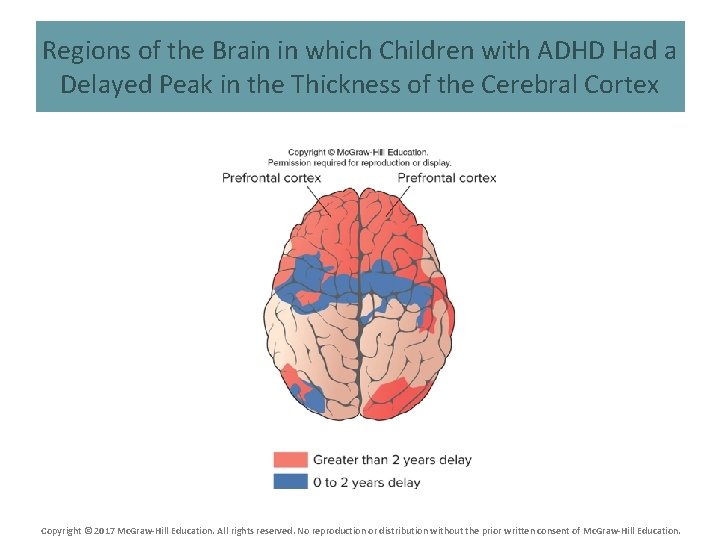 Regions of the Brain in which Children with ADHD Had a Delayed Peak in