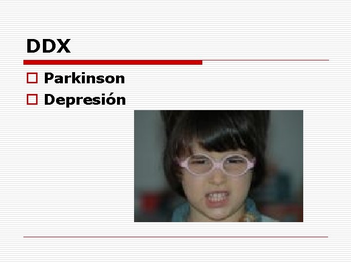 DDX o Parkinson o Depresión 