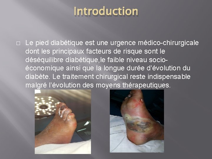 Introduction � Le pied diabétique est une urgence médico-chirurgicale dont les principaux facteurs de