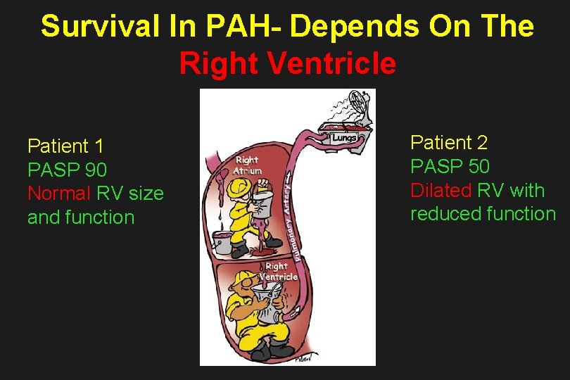 Survival In PAH- Depends On The Right Ventricle Patient 1 PASP 90 Normal RV