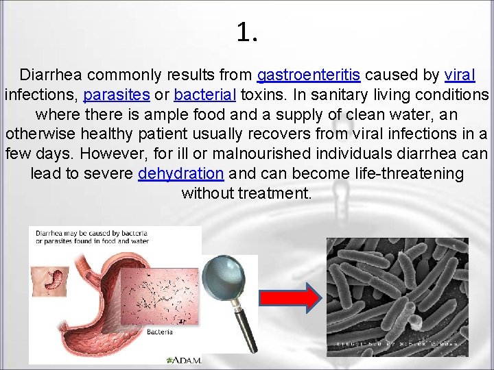1. Diarrhea commonly results from gastroenteritis caused by viral infections, parasites or bacterial toxins. 1. Diarrhea commonly results from gastroenteritis caused by viral infections, parasites or bacterial toxins.