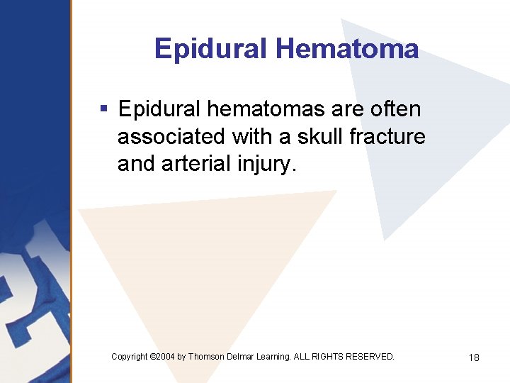 Epidural Hematoma § Epidural hematomas are often associated with a skull fracture and arterial