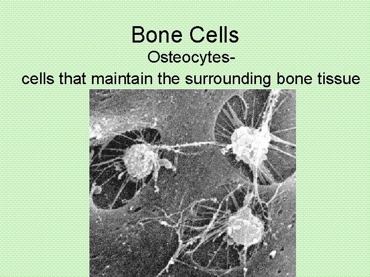 Bone Cells Osteocytescells that maintain the surrounding bone tissue 