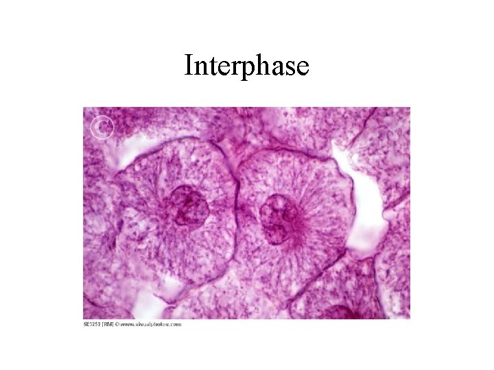 Interphase 