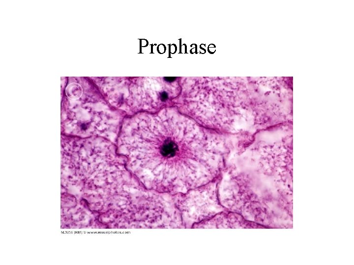 Prophase 