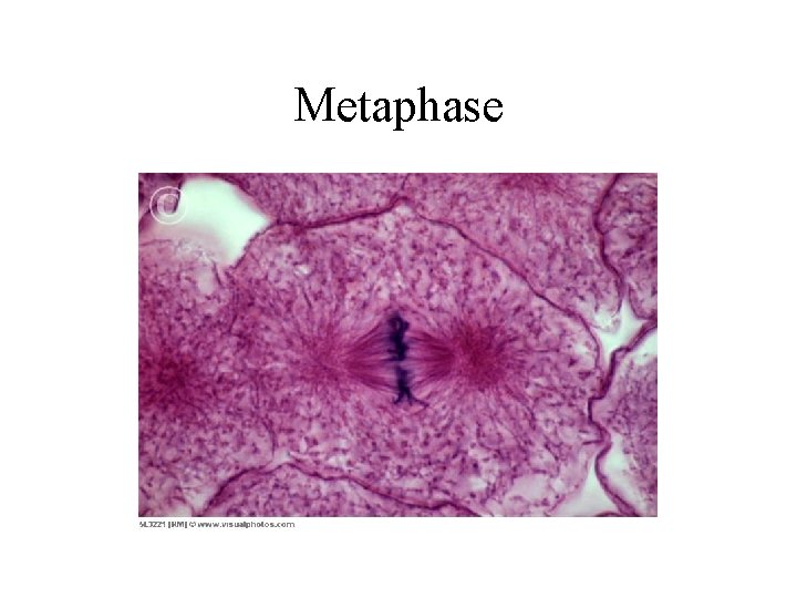 Metaphase 