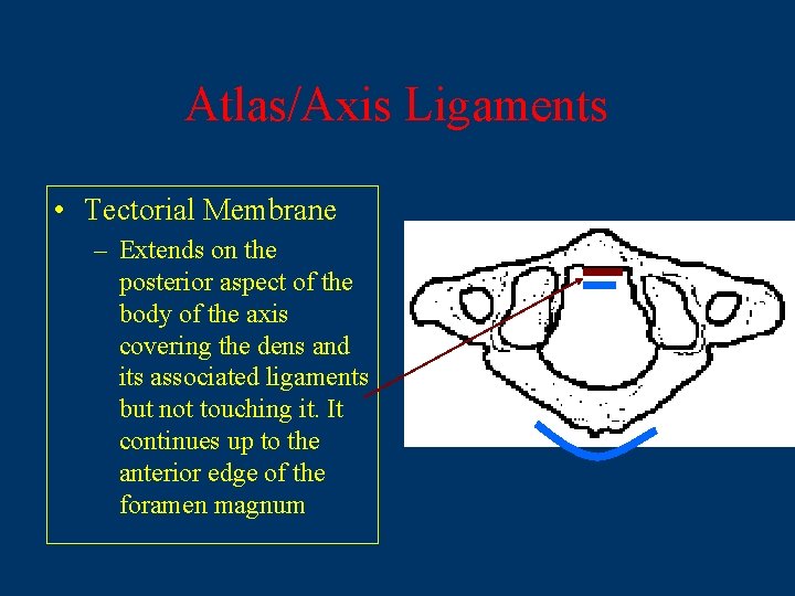Atlas/Axis Ligaments • Tectorial Membrane – Extends on the posterior aspect of the body