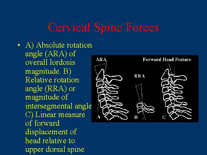 Cervical Spine Forces • A) Absolute rotation angle (ARA) of overall lordosis magnitude. B)