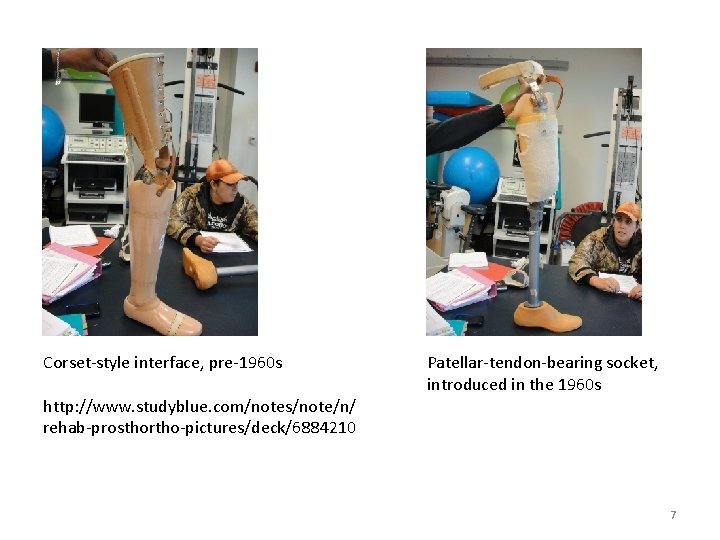 Corset‐style interface, pre‐ 1960 s http: //www. studyblue. com/notes/note/n/ rehab‐prosthortho‐pictures/deck/6884210 Patellar‐tendon‐bearing socket, introduced in