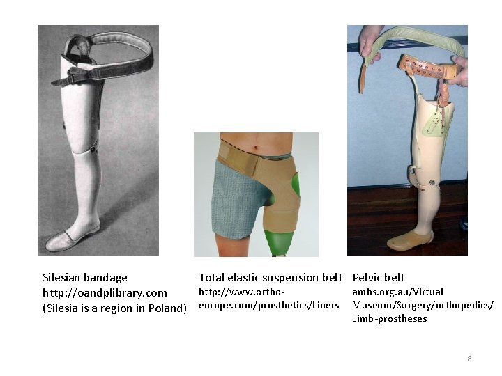 Total elastic suspension belt Pelvic belt Silesian bandage http: //www. ortho‐ amhs. org. au/Virtual