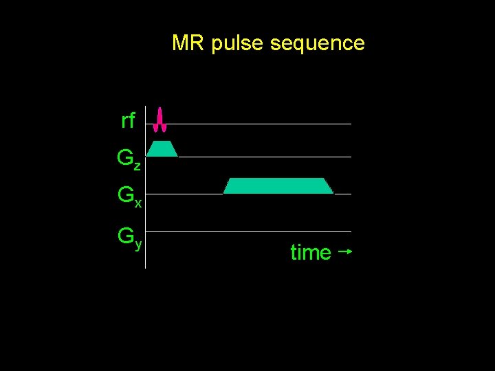 MR pulse sequence rf Gz Gx Gy time 