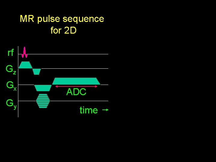 MR pulse sequence for 2 D rf Gz Gx Gy ADC time 