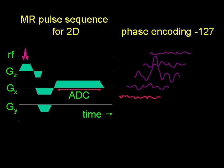 MR pulse sequence for 2 D rf Gz Gx Gy ADC time phase encoding