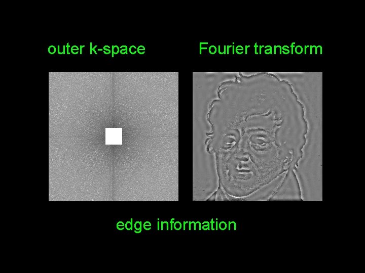 outer k-space Fourier transform edge information 