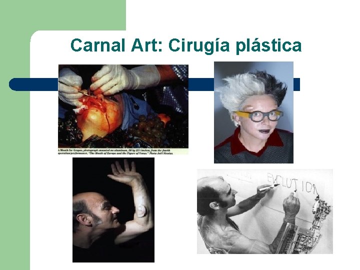 Carnal Art: Cirugía plástica 