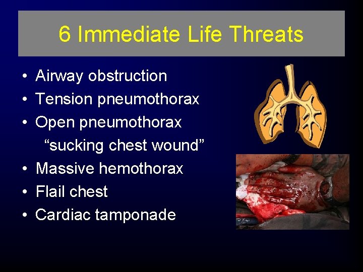 6 Immediate Life Threats • Airway obstruction • Tension pneumothorax • Open pneumothorax “sucking