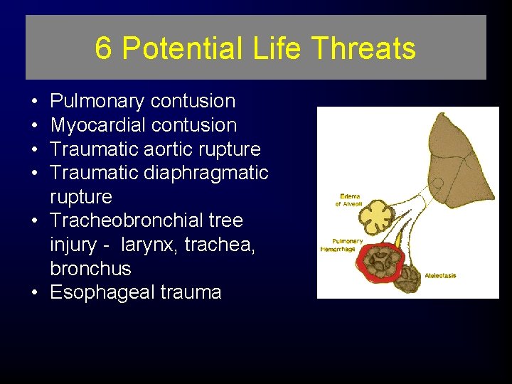 6 Potential Life Threats • • Pulmonary contusion Myocardial contusion Traumatic aortic rupture Traumatic