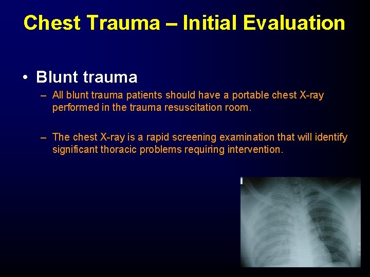 Chest Trauma – Initial Evaluation • Blunt trauma – All blunt trauma patients should