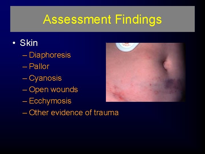 Assessment Findings • Skin – Diaphoresis – Pallor – Cyanosis – Open wounds –