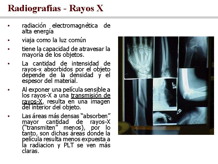 Radiografías - Rayos X • • • radiación electromagnética de alta energía viaja como
