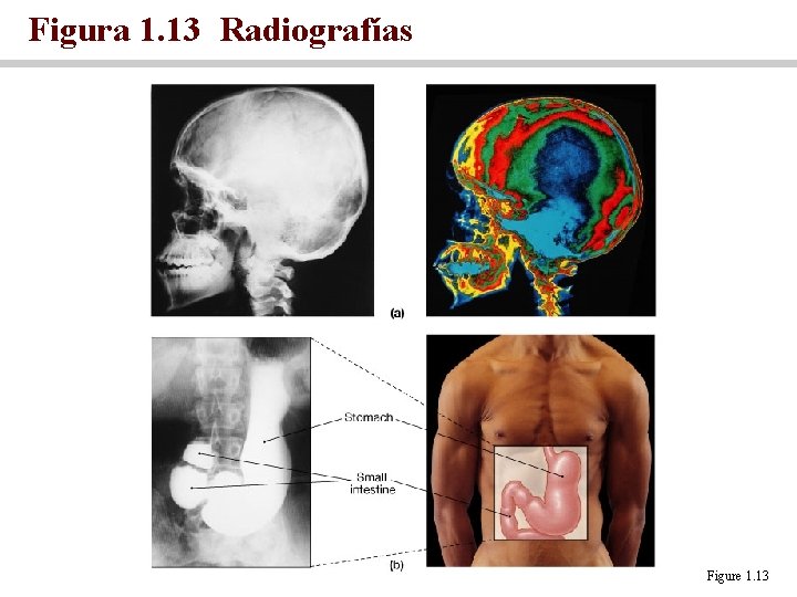 Figura 1. 13 Radiografías Figure 1. 13 
