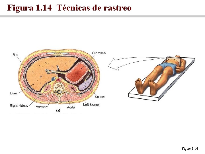 Figura 1. 14 Técnicas de rastreo Figure 1. 14 