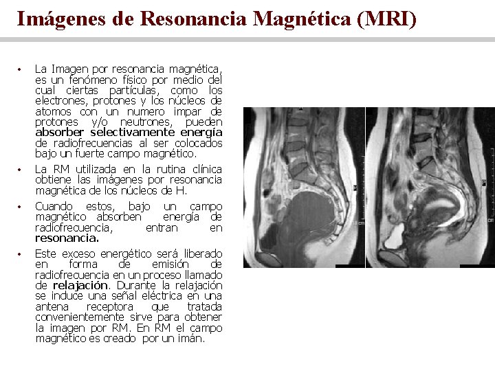 Imágenes de Resonancia Magnética (MRI) • • La Imagen por resonancia magnética, es un