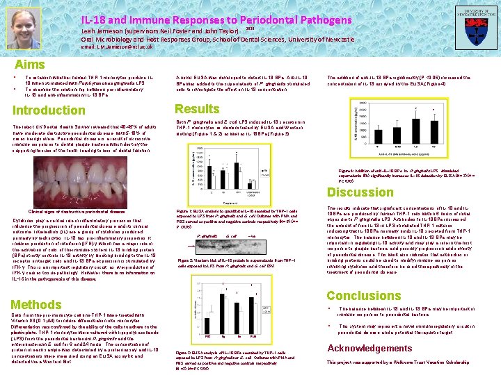 IL-18 and Immune Responses to Periodontal Pathogens Leah Jamieson (supervisors Neil Foster and John