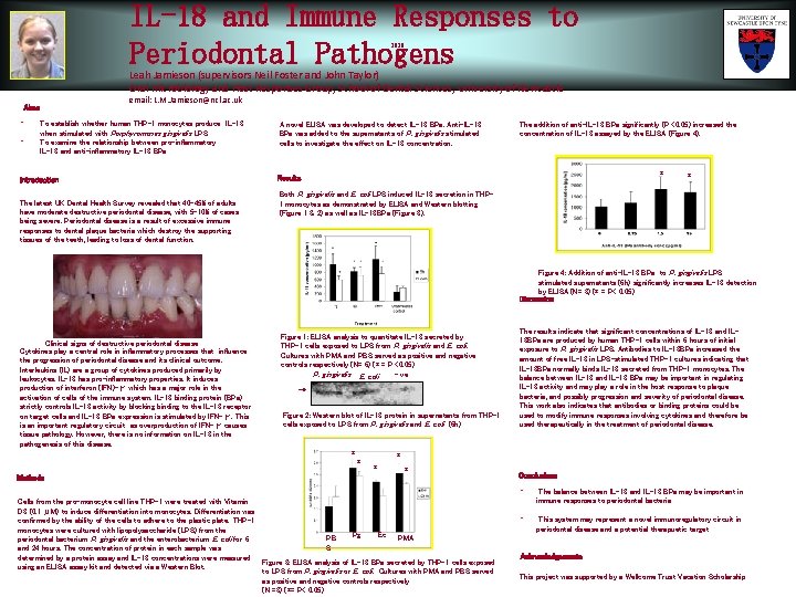 IL-18 and Immune Responses to Periodontal Pathogens 2020 Leah Jamieson (supervisors Neil Foster and