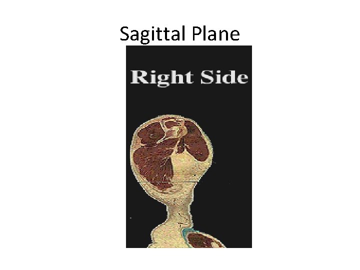 Sagittal Plane 