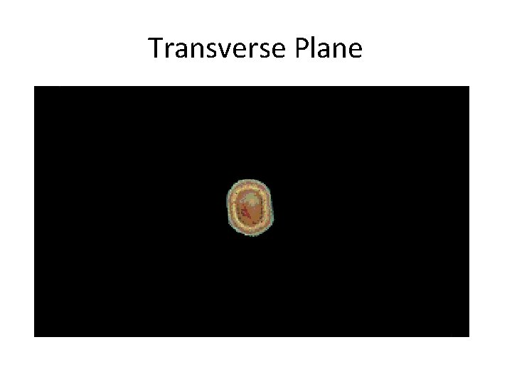 Transverse Plane 