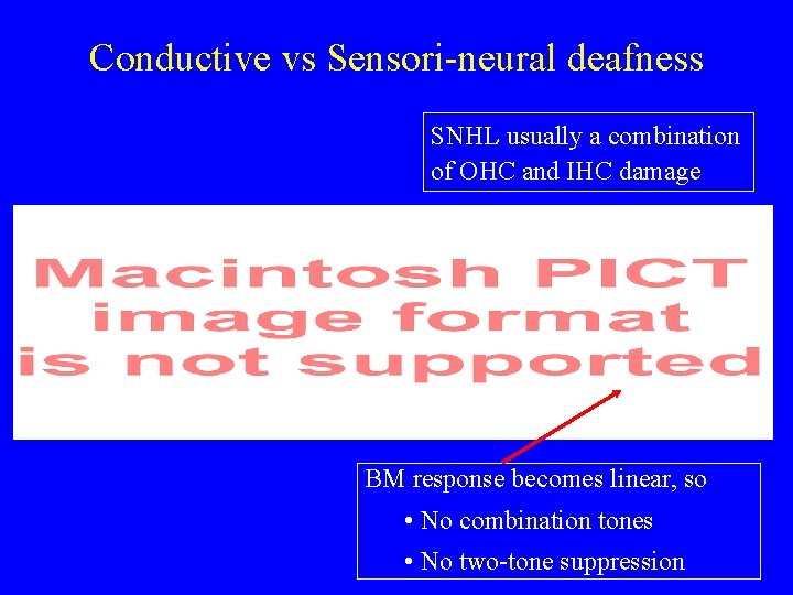 Conductive vs Sensori-neural deafness SNHL usually a combination of OHC and IHC damage BM