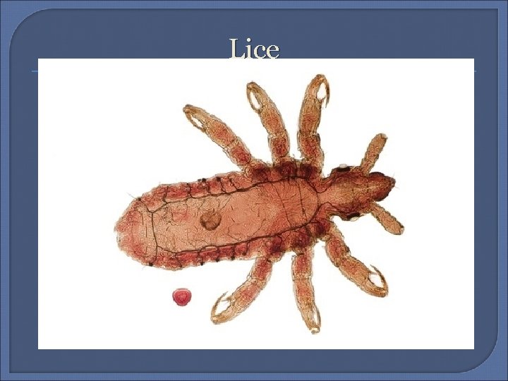 Lice 