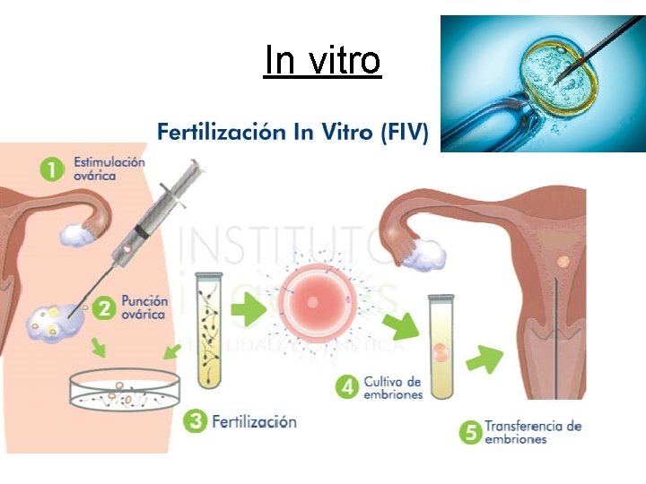 In vitro 