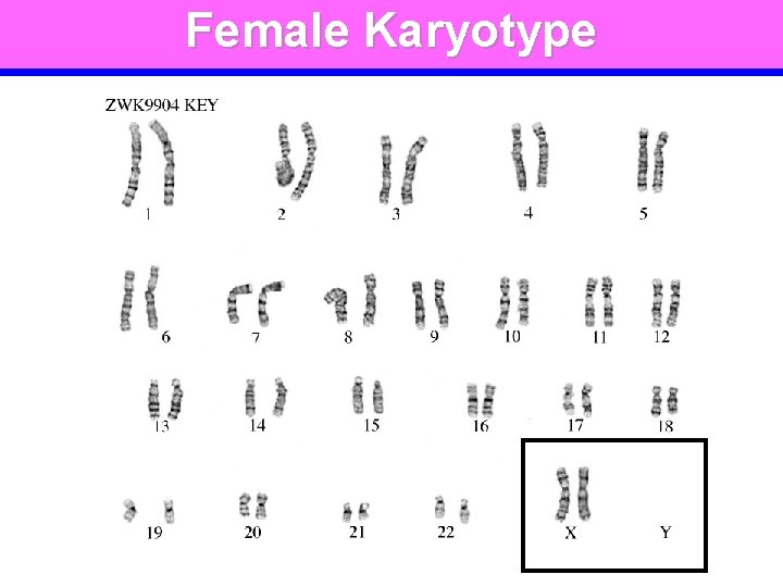 Female Karyotype 