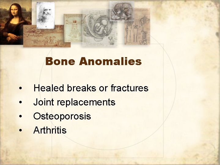 Bone Anomalies • • Healed breaks or fractures Joint replacements Osteoporosis Arthritis 