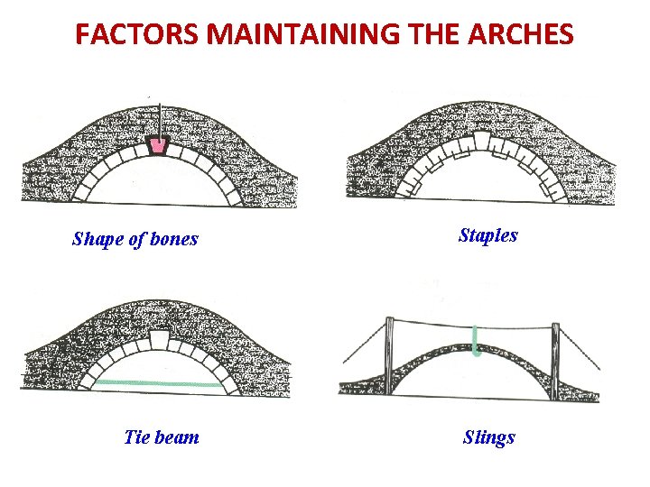 FACTORS MAINTAINING THE ARCHES Shape of bones Staples Tie beam Slings 