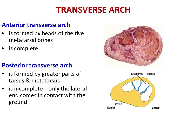 TRANSVERSE ARCH Anterior transverse arch • is formed by heads of the five metatarsal