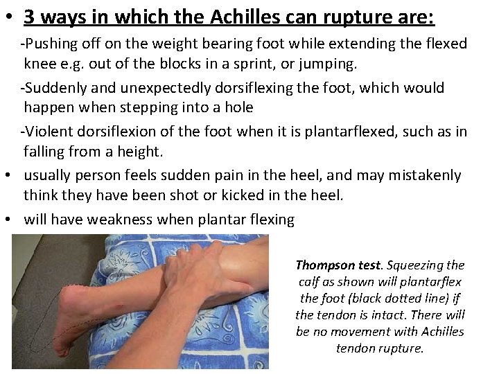  • 3 ways in which the Achilles can rupture are: -Pushing off on