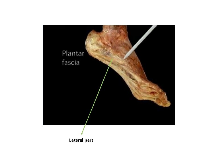Lateral part 