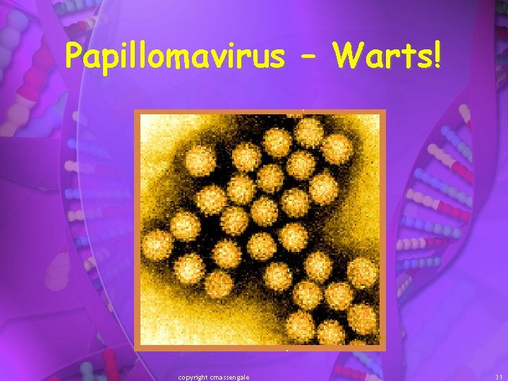 Papillomavirus – Warts! copyright cmassengale 31 