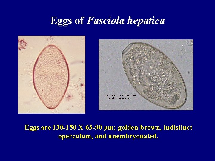 Eggs of Fasciola hepatica Eggs are 130 -150 X 63 -90 μm; golden brown,