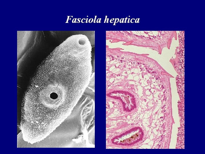 Fasciola hepatica 