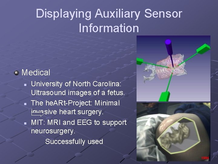Displaying Auxiliary Sensor Information Medical n n n University of North Carolina: Ultrasound images