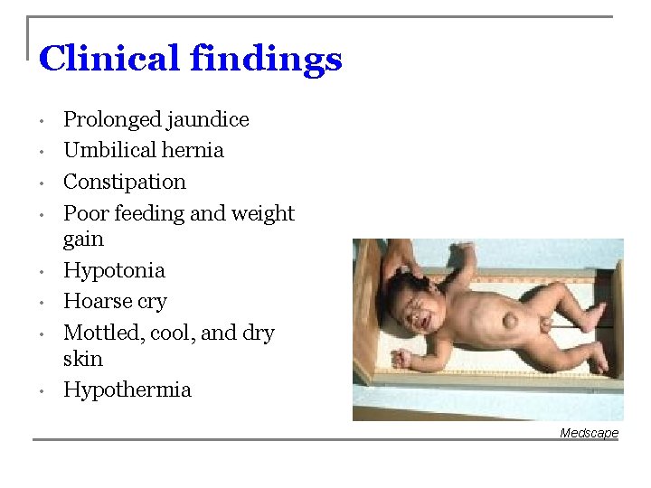 Clinical findings • • Prolonged jaundice Umbilical hernia Constipation Poor feeding and weight gain