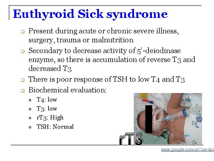 Euthyroid Sick syndrome q q Present during acute or chronic severe illness, surgery, trauma